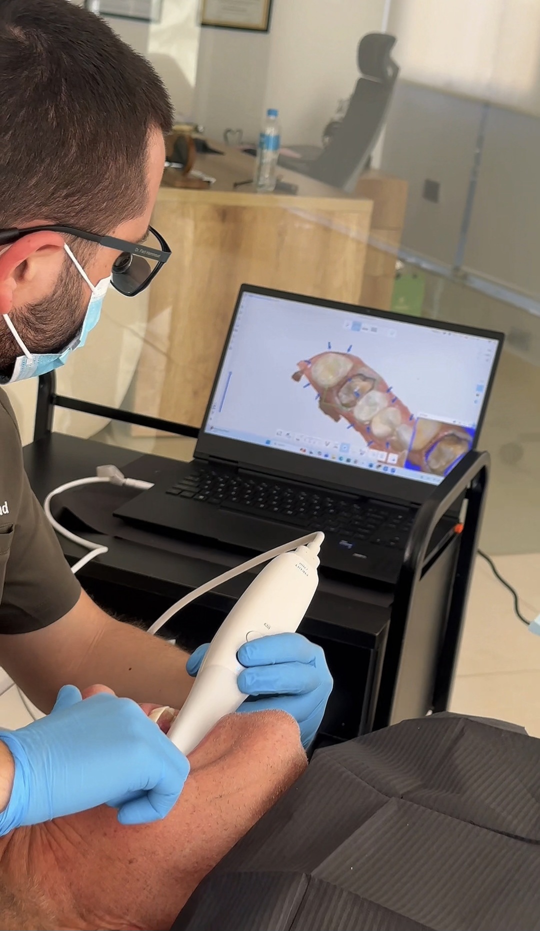 Intraoral Scanner