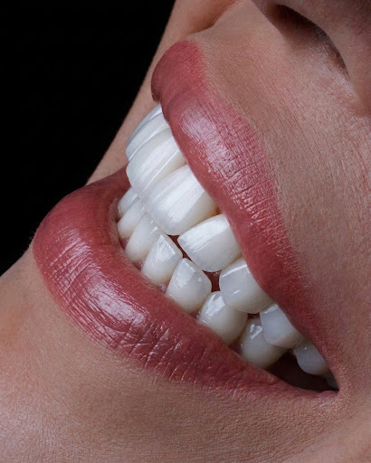 Natural Veneers